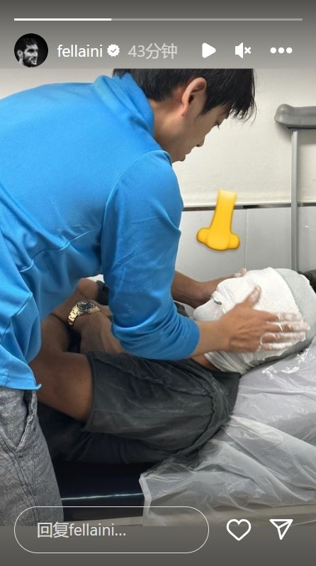 变身面具侠!费莱尼晒照,在给鼻子定制面具